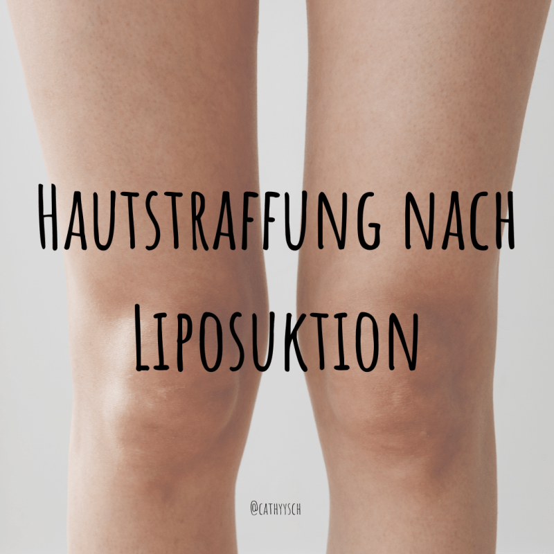 Hautstraffung nach Liposuktion